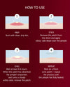 Acne patches