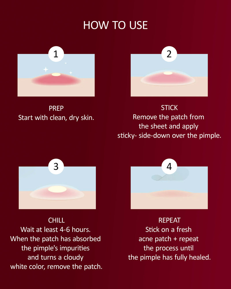 Acne patches