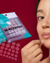 Acne patches